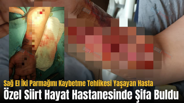 Sağ El İki Parmağını Kaybetme Tehlikesi Yaşayan Hasta Özel Siirt Hayat Hastanesinde Şifa Buldu