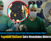 Siirt’te 78 Yaşındaki Hastanın Safra Kesesinden Binlerce Taş Çıktı