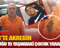 SİİRT’TE AKREBİN SOKTUĞU ÇOCUK YARALANDI